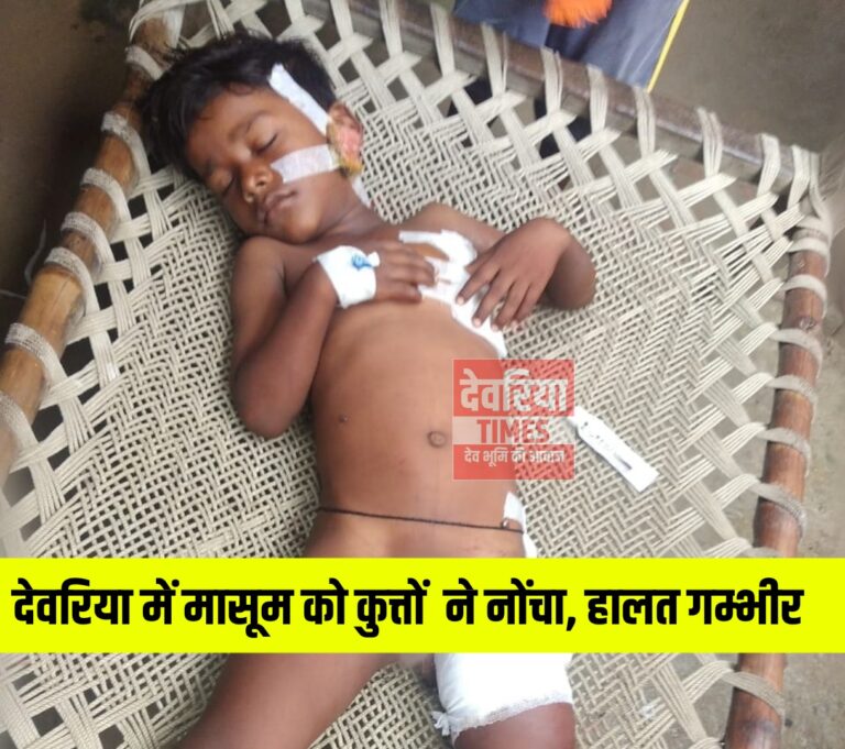 Deoria News देवरिया के भटनी में कुत्तों के झुंड ने मासूम को नोंचा, हालत गंभीर